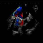 ETE-pre-intervencion